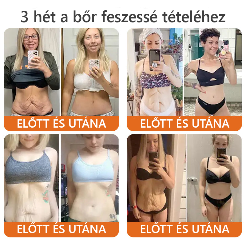 Készült és szállítva Magyarországról✨Daasry® méhméreg átfogó krém 🔥 UTOLSÓ NAP 80% KEDVEZMÉNY