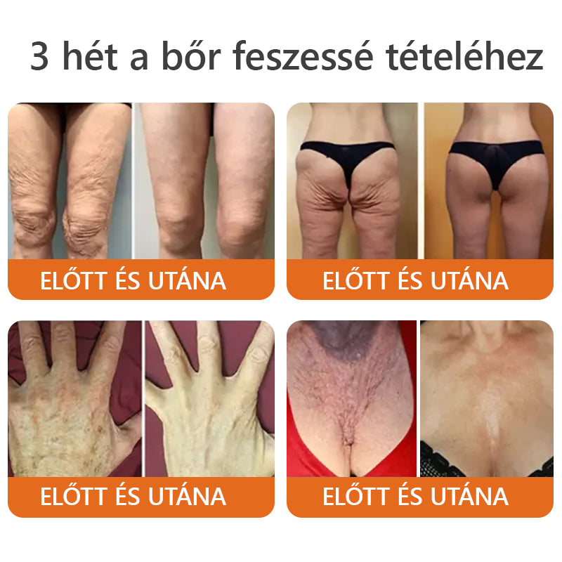 Készült és szállítva Magyarországról✨Daasry® méhméreg átfogó krém 🔥 UTOLSÓ NAP 80% KEDVEZMÉNY