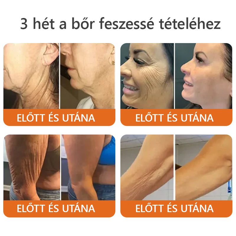 Készült és szállítva Magyarországról✨Daasry® méhméreg átfogó krém 🔥 UTOLSÓ NAP 80% KEDVEZMÉNY