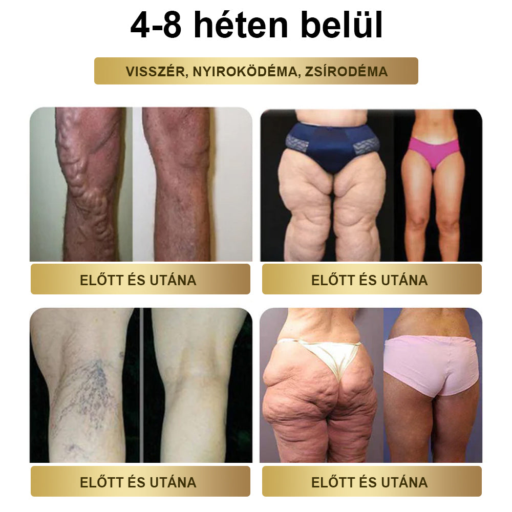 🎗TOOYES® Metatrolide & Moringa GLP-1 Aktiváció, Almaecet, Kurkuma Gyógyhatású Szájoldat: Elhízás, Szív- és Érrendszeri Betegségek, Cukorbetegség, Alvási Apnoé, Ízületi Problémák és Még Több