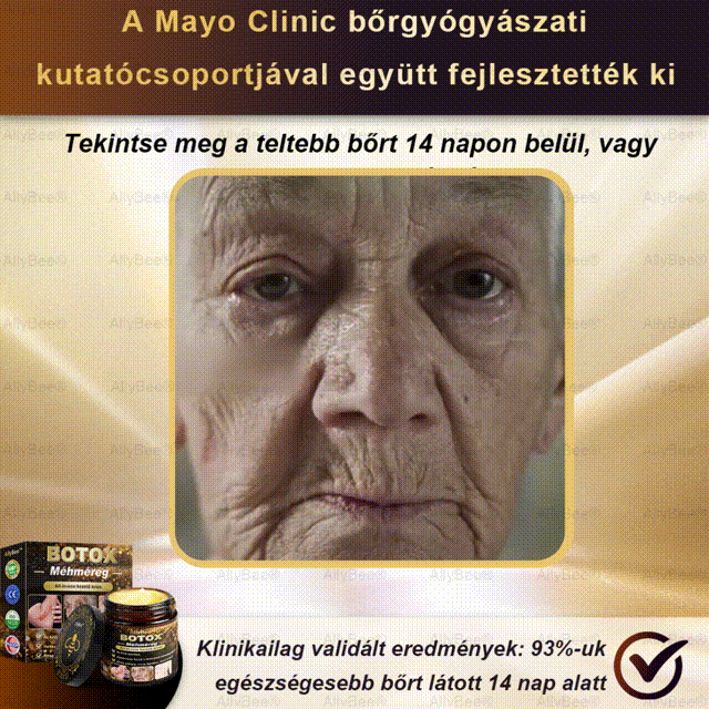 đAllyBeeÂź Botox BĆrĂĄpolĂł KrĂ©m RĂĄnctalanĂtĂĄs, HidratĂĄlĂĄs, BĆrregenerĂĄlĂĄs, Egyenletes BĆrtĂłnus, PattanĂĄs- Ă©s SötĂ©tfolt KezelĂ©s, Szemölcs- Ă©s Anyajegyek EltĂĄvolĂtĂĄsa