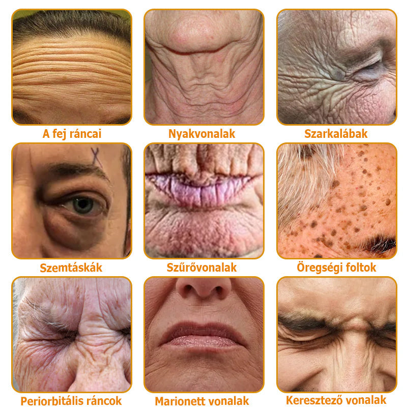 đAllyBeeÂź Botox BĆrĂĄpolĂł KrĂ©m RĂĄnctalanĂtĂĄs, HidratĂĄlĂĄs, BĆrregenerĂĄlĂĄs, Egyenletes BĆrtĂłnus, PattanĂĄs- Ă©s SötĂ©tfolt KezelĂ©s, Szemölcs- Ă©s Anyajegyek EltĂĄvolĂtĂĄsa