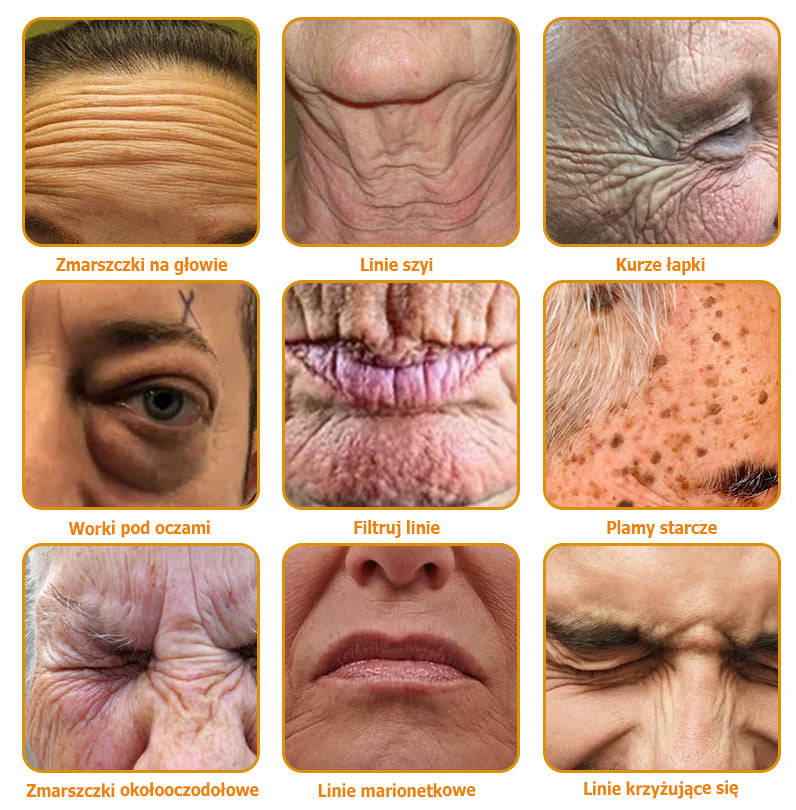 👨🔬 AllyBee® Krem Botox do pielęgnacji skóry - Wygładzanie zmarszczek, Nawilżenie, Regeneracja skóry, Wyrównanie kolorytu skóry, Leczenie trądziku i przebarwień, Usuwanie brodawek i znamion.--pl