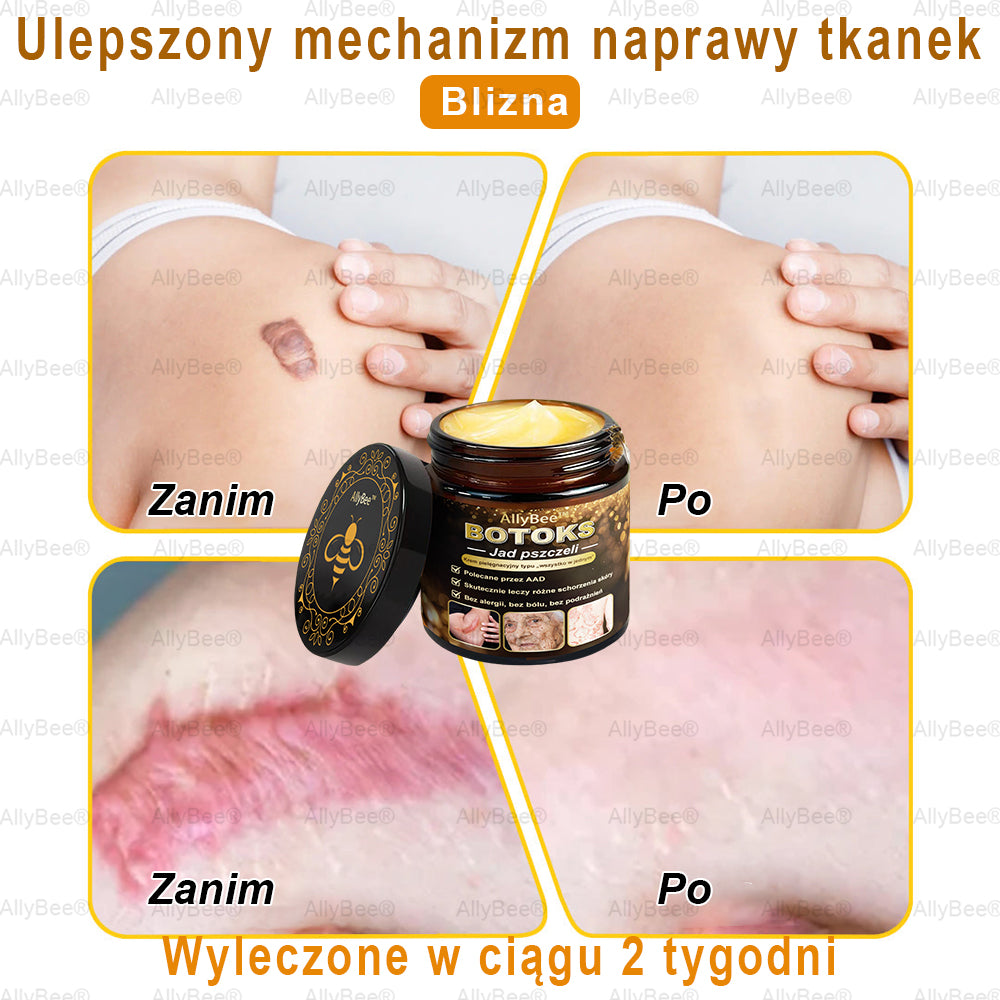 👨🔬 AllyBee® Krem Botox do pielęgnacji skóry - Wygładzanie zmarszczek, Nawilżenie, Regeneracja skóry, Wyrównanie kolorytu skóry, Leczenie trądziku i przebarwień, Usuwanie brodawek i znamion.--pl