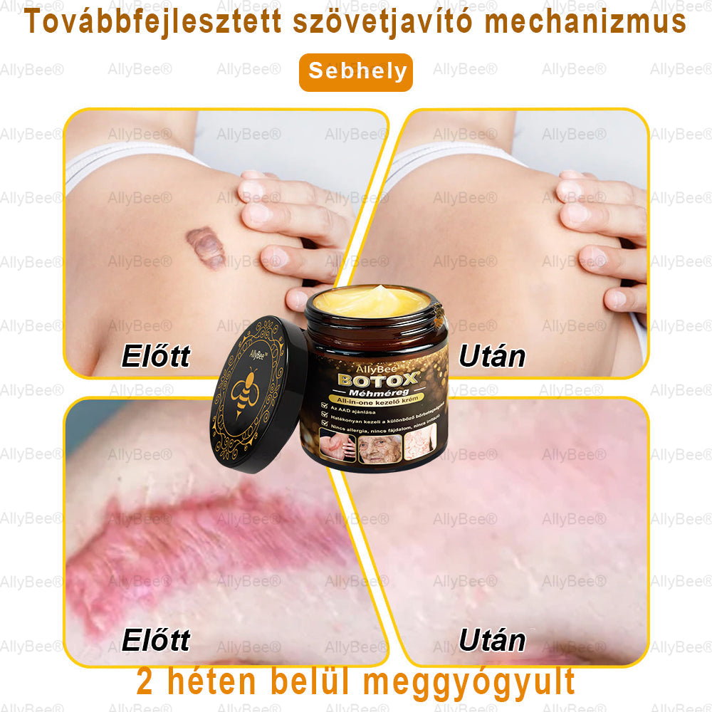 đAllyBeeÂź Botox BĆrĂĄpolĂł KrĂ©m RĂĄnctalanĂtĂĄs, HidratĂĄlĂĄs, BĆrregenerĂĄlĂĄs, Egyenletes BĆrtĂłnus, PattanĂĄs- Ă©s SötĂ©tfolt KezelĂ©s, Szemölcs- Ă©s Anyajegyek EltĂĄvolĂtĂĄsa