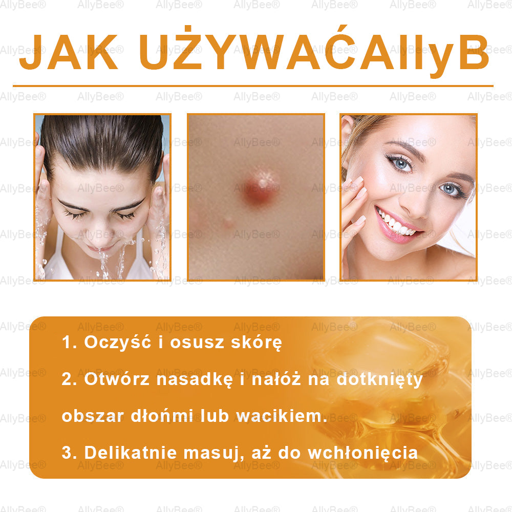 👨🔬 AllyBee® Krem Botox do pielęgnacji skóry - Wygładzanie zmarszczek, Nawilżenie, Regeneracja skóry, Wyrównanie kolorytu skóry, Leczenie trądziku i przebarwień, Usuwanie brodawek i znamion.--pl