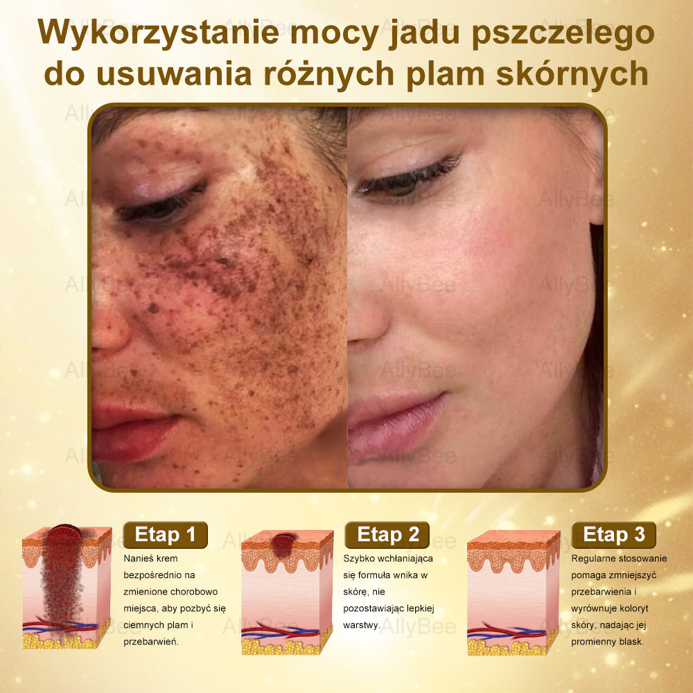 👨🔬 AllyBee® Krem Botox do pielęgnacji skóry - Wygładzanie zmarszczek, Nawilżenie, Regeneracja skóry, Wyrównanie kolorytu skóry, Leczenie trądziku i przebarwień, Usuwanie brodawek i znamion.--pl