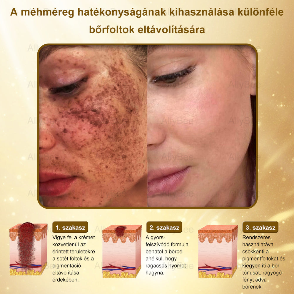 đAllyBeeÂź Botox BĆrĂĄpolĂł KrĂ©m RĂĄnctalanĂtĂĄs, HidratĂĄlĂĄs, BĆrregenerĂĄlĂĄs, Egyenletes BĆrtĂłnus, PattanĂĄs- Ă©s SötĂ©tfolt KezelĂ©s, Szemölcs- Ă©s Anyajegyek EltĂĄvolĂtĂĄsa