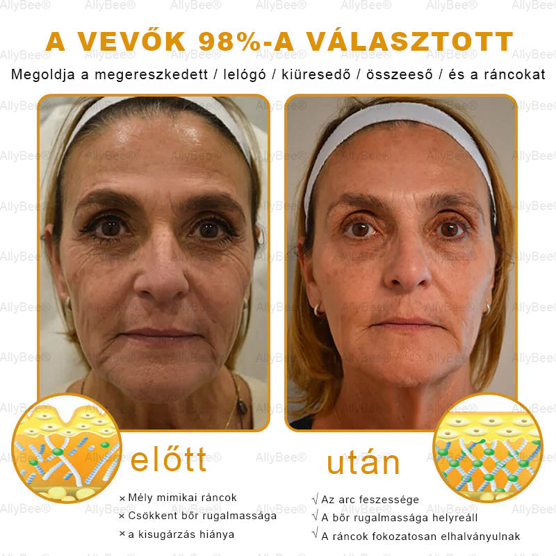Mayo Clinic tisztviselő: AllyBee® bőrkezelő krém öregedésgátló, hidratáló, bőrjavító, egyenletes tónus, pattanások és sötét foltok kezelése, szemölcs és anyajegy eltávolítása, pikkelysömör enyhítése