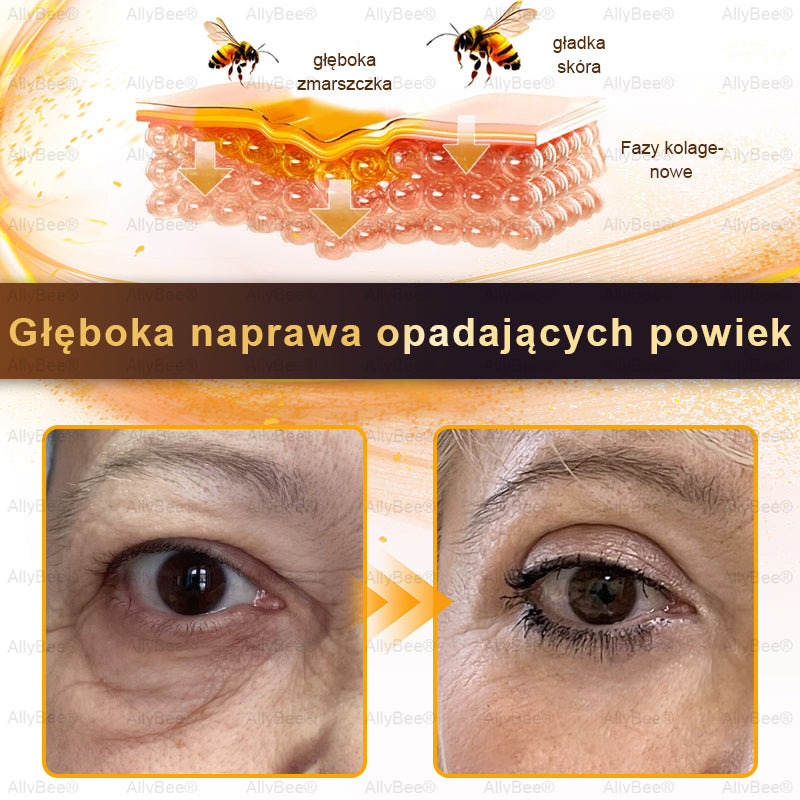 👨🔬 AllyBee® Krem Botox do pielęgnacji skóry - Wygładzanie zmarszczek, Nawilżenie, Regeneracja skóry, Wyrównanie kolorytu skóry, Leczenie trądziku i przebarwień, Usuwanie brodawek i znamion.--pl