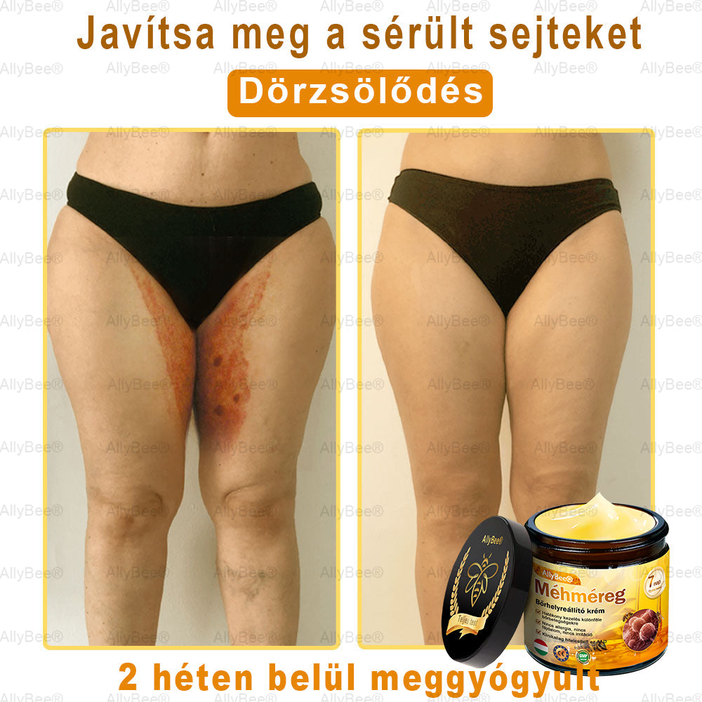 Mayo Clinic tisztviselő: AllyBee® bőrkezelő krém öregedésgátló, hidratáló, bőrjavító, egyenletes tónus, pattanások és sötét foltok kezelése, szemölcs és anyajegy eltávolítása, pikkelysömör enyhítése