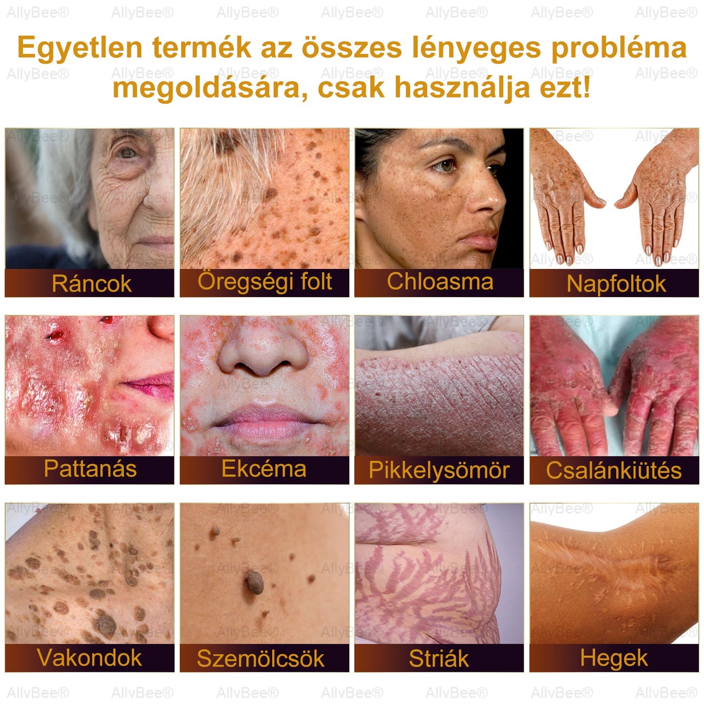 đAllyBeeÂź Botox BĆrĂĄpolĂł KrĂ©m RĂĄnctalanĂtĂĄs, HidratĂĄlĂĄs, BĆrregenerĂĄlĂĄs, Egyenletes BĆrtĂłnus, PattanĂĄs- Ă©s SötĂ©tfolt KezelĂ©s, Szemölcs- Ă©s Anyajegyek EltĂĄvolĂtĂĄsa