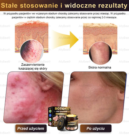 👨‍🔬 AllyBee® Krem Botox do pielęgnacji skóry - Wygładzanie zmarszczek, Nawilżenie, Regeneracja skóry, Wyrównanie kolorytu skóry, Leczenie trądziku i przebarwień, Usuwanie brodawek i znamion.--pl