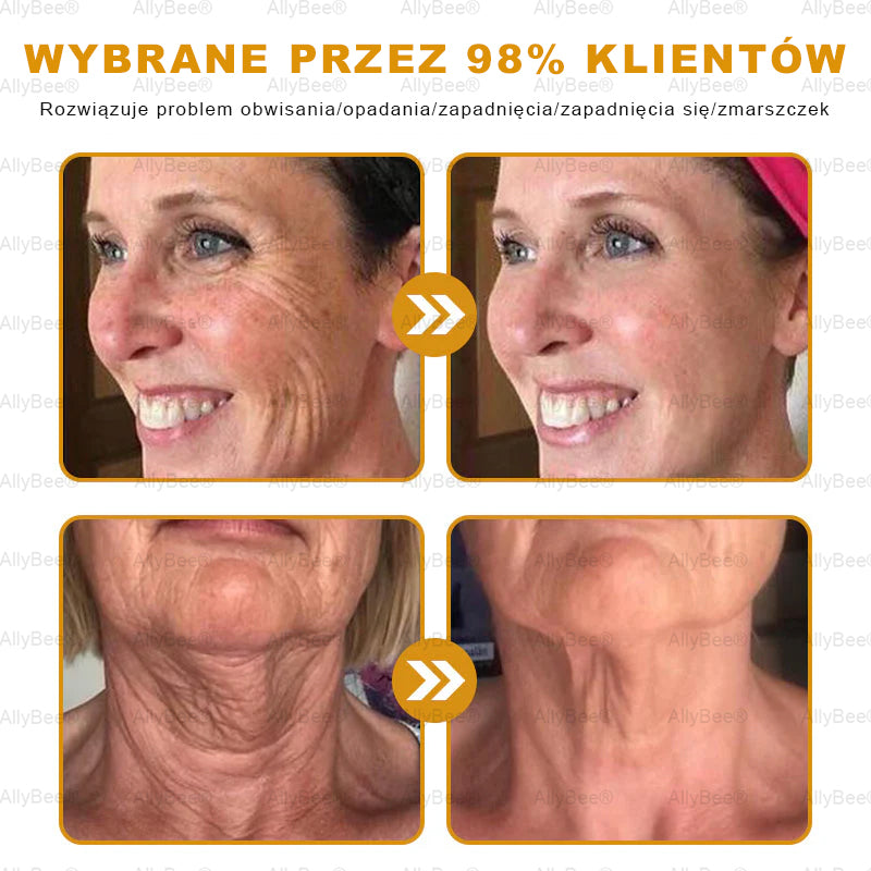 👨‍🔬 AllyBee® Krem Botox do pielęgnacji skóry - Wygładzanie zmarszczek, Nawilżenie, Regeneracja skóry, Wyrównanie kolorytu skóry, Leczenie trądziku i przebarwień, Usuwanie brodawek i znamion.--pl