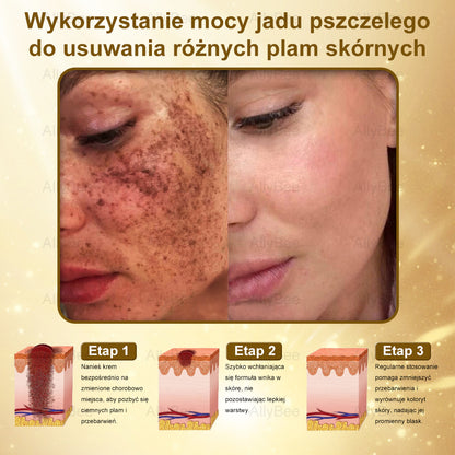 👨‍🔬 AllyBee® Krem Botox do pielęgnacji skóry - Wygładzanie zmarszczek, Nawilżenie, Regeneracja skóry, Wyrównanie kolorytu skóry, Leczenie trądziku i przebarwień, Usuwanie brodawek i znamion.--pl