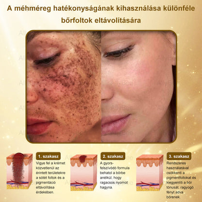 AllyBee® Botox Bőrápoló Krém Ránctalanítás, Hidratálás, Bőrregenerálás, Egyenletes Bőrtónus, Pattanás- és Sötétfolt Kezelés, Szemölcs- és Anyajegyek Eltávolítása