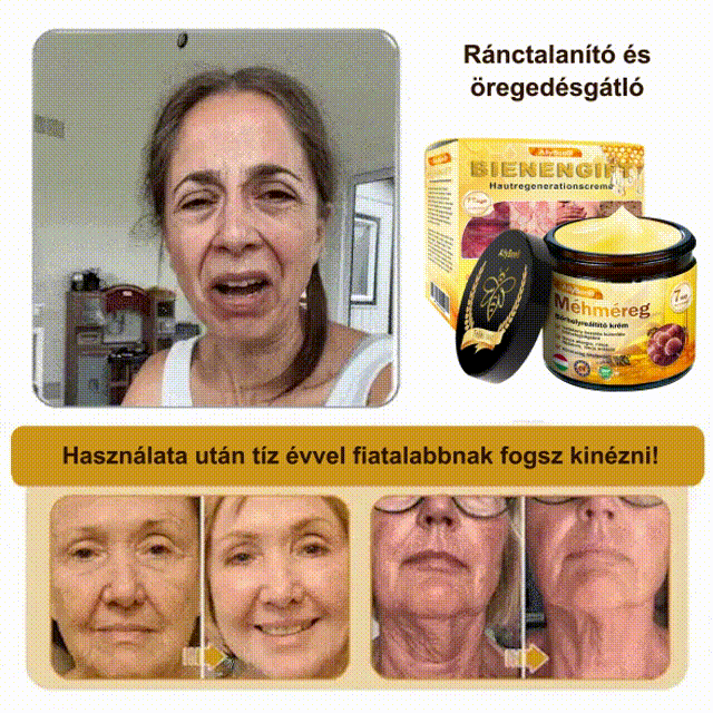 AllyBee® bőrkezelő krém öregedésgátló, hidratáló, bőrjavító, egyenletes tónus, pattanások és sötét foltok kezelése, szemölcs és anyajegy eltávolítása, pikkelysömör enyhítése