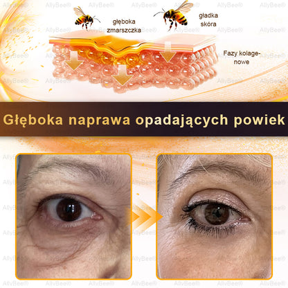 👨‍🔬 AllyBee® Krem Botox do pielęgnacji skóry - Wygładzanie zmarszczek, Nawilżenie, Regeneracja skóry, Wyrównanie kolorytu skóry, Leczenie trądziku i przebarwień, Usuwanie brodawek i znamion.--pl