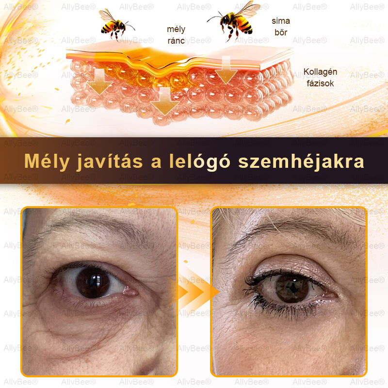AllyBee® Botox Bőrápoló Krém Ránctalanítás, Hidratálás, Bőrregenerálás, Egyenletes Bőrtónus, Pattanás- és Sötétfolt Kezelés, Szemölcs- és Anyajegyek Eltávolítása