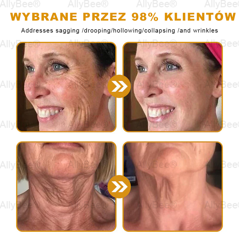 AllyBee® Krem do pielęgnacji skóry – przeciwstarzeniowy, nawilżający, regenerujący skórę, wyrównujący koloryt, leczenie trądziku i ciemnych plam, usuwanie brodawek i znamion, ulga w łuszczycy.