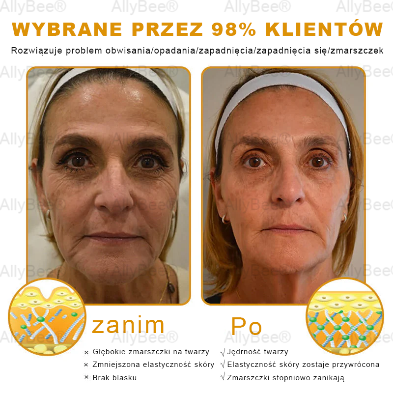 AllyBee® Krem do pielęgnacji skóry – przeciwstarzeniowy, nawilżający, regenerujący skórę, wyrównujący koloryt, leczenie trądziku i ciemnych plam, usuwanie brodawek i znamion, ulga w łuszczycy.
