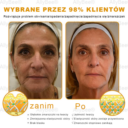AllyBee® Krem do pielęgnacji skóry – przeciwstarzeniowy, nawilżający, regenerujący skórę, wyrównujący koloryt, leczenie trądziku i ciemnych plam, usuwanie brodawek i znamion, ulga w łuszczycy.