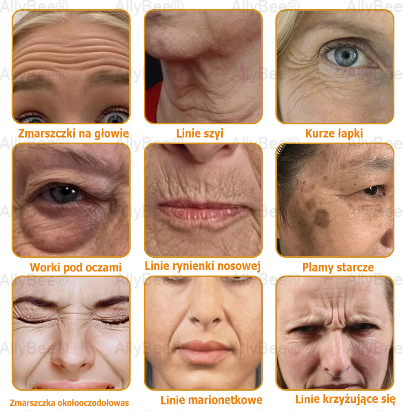 AllyBee® Krem do pielęgnacji skóry – przeciwstarzeniowy, nawilżający, regenerujący skórę, wyrównujący koloryt, leczenie trądziku i ciemnych plam, usuwanie brodawek i znamion, ulga w łuszczycy.