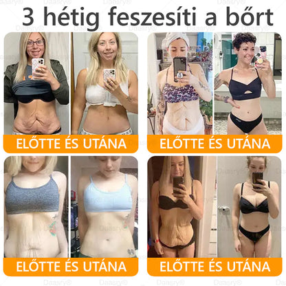 Daasry® Méhméreg Kezelő Krém, méhméreg peptidekkel, botulinum toxinnal, hialuronsavval és kollagénnel💧. Hatékonyan küzd a ráncok, finom vonalak, megereszkedés, terhességi csíkok és sötét foltok ellen — feszesítés, emelés és kiemelkedő eredmények!
