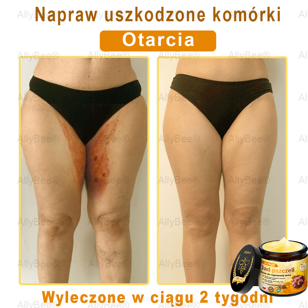 AllyBee® Krem do pielęgnacji skóry – przeciwstarzeniowy, nawilżający, regenerujący skórę, wyrównujący koloryt, leczenie trądziku i ciemnych plam, usuwanie brodawek i znamion, ulga w łuszczycy.