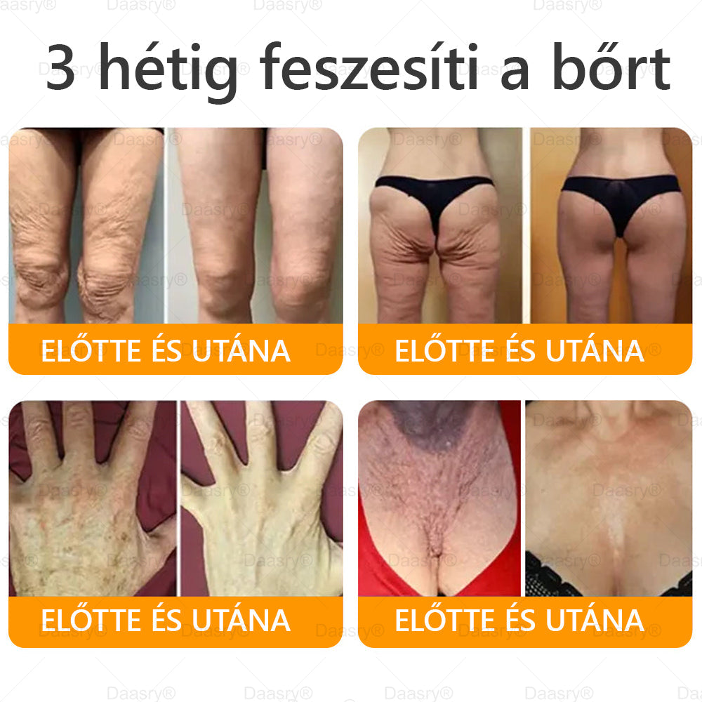 Daasry® Méhméreg Kezelő Krém, méhméreg peptidekkel, botulinum toxinnal, hialuronsavval és kollagénnel💧. Hatékonyan küzd a ráncok, finom vonalak, megereszkedés, terhességi csíkok és sötét foltok ellen — feszesítés, emelés és kiemelkedő eredmények!