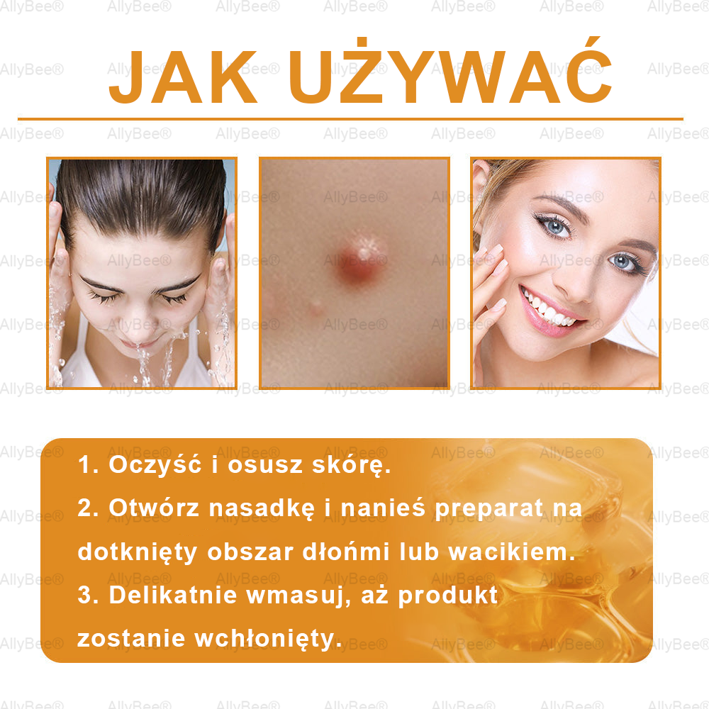 AllyBee® Krem do pielęgnacji skóry – przeciwstarzeniowy, nawilżający, regenerujący skórę, wyrównujący koloryt, leczenie trądziku i ciemnych plam, usuwanie brodawek i znamion, ulga w łuszczycy.